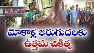 విశాఖ కేజీహెచ్‌లో మోకాళ్లు అరుగుదలకు ఉత్తమ చికిత్స | Best Treatment For Knee Pain at Vizag KGH