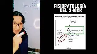 BASES FISIOLOGICAS PARA ENTENDER Y MANEJAR EL SHOCK