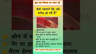 कैसे पहचानें कि नसें ब्लॉक हो गई हैं? || Blocked veins symptoms #health #healthy #shorts #healthtips