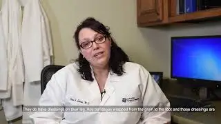 What is recovery like after a laser varicose vein surgery?