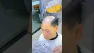 Amazing Hair Transformation | Hair Replacement System | Fight against the Male Bald Head | Hair Loss