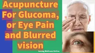 For Glaucoma, or Eye Pain and Blurred Vision - Self Ear Acupuncture Acupressure