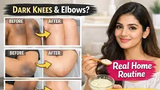 Knee & Elbow Whitening Routine at Home | Remove Darkness Naturally | Real Results