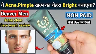 Denver Acne Clear Face Wash Review | denver acne clear face wash | denver face wash