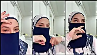 Neelofa || Cerita Tentang Parut Di Dahi