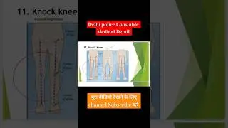 Delhi Police मेडिकल मे क्या क्या होता है ?  || Delhi police  Medical  #delhipoliceconstable #viral