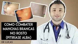 COMO COMBATER MANCHAS BRANCAS NO ROSTO (PITIRIASE ALBA) DR LUCAS FUSTINONI