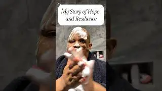 My Story of living with Parry Romberg Syndrome