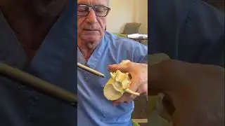 Spinal Fusions and FlareHawk Endoscopic from Integrity Instruments