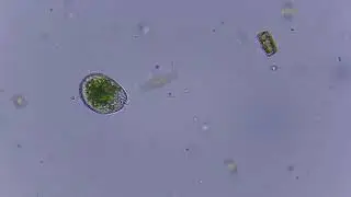 small ciliate with endosymbiotic algae