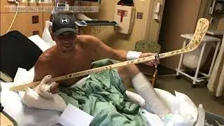 Lineman survives being electrocuted