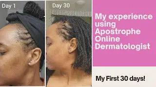 Skin Care | My Experience with Apostrophe- Online Dermatologist | First 30 Days