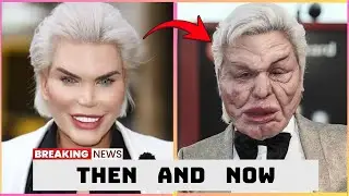 15 celebrity plastic surgery disasters that will leave you unrecognizable  Then and now 2026