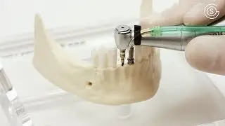 Implantation von zwei durchmesserreduzierten Implantaten am Modell Mandibula B6 bone by GOS&reg;