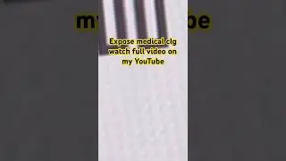 True event! Expose medical clg #youtube #shots #viralvideo #storytime #story #medical