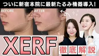 【ついに導入】新宿本院で受けられるようになりました！【XERF】
