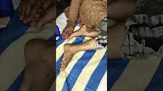 Stiff Neck को खत्म करें | ये आसान Acupressure Points दबाएँ #acupressure #shorts #holistic wealth
