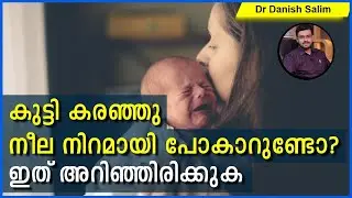 582: 👶 കുട്ടി കരഞ്ഞു നീല നിറമായി പോകാറുണ്ടോ?  Learn what to do when baby turns blue while crying..
