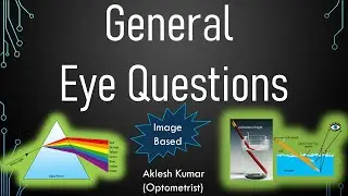 General Eye Questions For Exam
