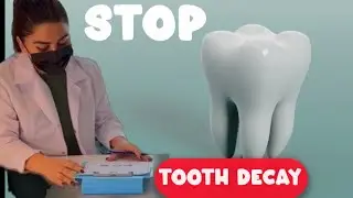 Can Eating Cheese Really Stop Tooth Decay? Shocking Results