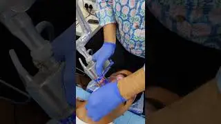 Acne Scar Treatment in Jaipur #acne  #radiantskinclinic #skintreatments  #drvishalchugh