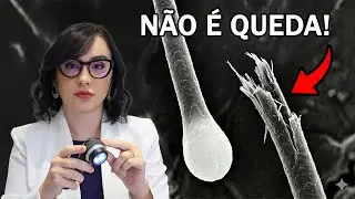 Seu Cabelo N&atilde;o Est&aacute; Caindo, Est&aacute; Quebrando &mdash; E Tratar Errado S&oacute; Piora!