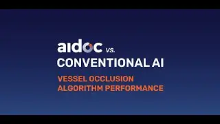Aidoc vs. Conventional AI: Vessel Occlusion Algorithm Performance
