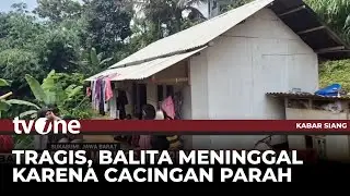 Kisah Tragis Dialami Balita di Sukabumi, Menderita Cacingan Parah dan Tidak Diobati Sejak Awal