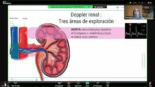 46 - Doppler renal