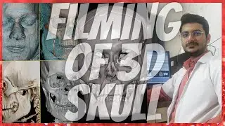 How to make CT Scan 3D Face/skull Filming #ctscan #radiologytechnologist #radioimaging