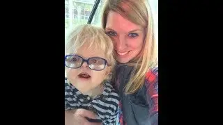 Cameron Elliott, Apert Syndrome