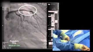 23 minutes - the story of a real heart attack, Oxford