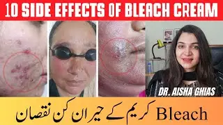 10 Side Effects Of Bleach Cream On Face | Does Bleaching Cream Work | Dr Aisha Ghias