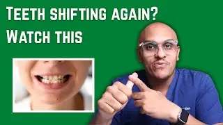Teeth shifting After Invisalign or Braces Fix it | Dr Salman Khan | DrBraces