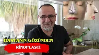 Hastanın Gözünden Rinoplasti!