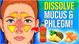 8 POWERFUL Mucus KILLING Foods - DISSOLVE MUCUS, PHLEGM, SINUS Instantly!