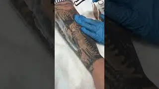 Painless tattoo removal #dubai#youtubeshorts #medicalclinic
