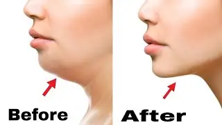 2 Easy Face Exercise To Get Rid Of Double Chin | Doctor Vivek