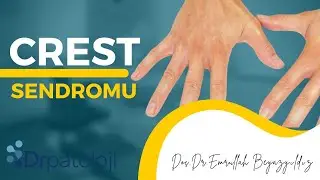 CREST SENDROMU