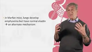 Marfan Syndrome - Case Studies in Personalized Medicine