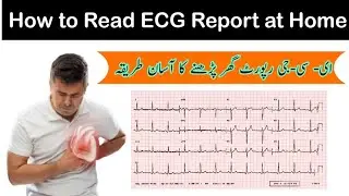 How to Read Your ECG Report at Home || A Step-by-Step Guide for Beginners