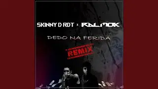 Dedo na Ferida (Remix)