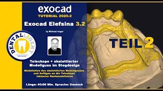 DENTALLIGENT - Exocad Elefsina 3.2  Tutorial 2025-2 - Telesk. + skelet. Mogul im Stegdesign TEIL2