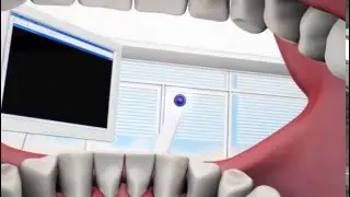VistaCam iX - Innovative Intraoralkamera