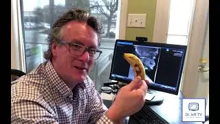 Chiropractic is Bananas!!!