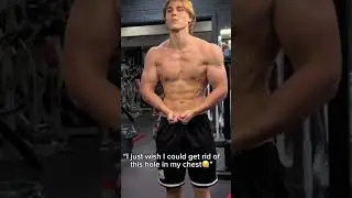 Fixed the hole in my chest ! Body transformation pectus
