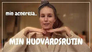 HUR JAG BLEV AV MED MIN ACNE │ Min hudvårdsrutin