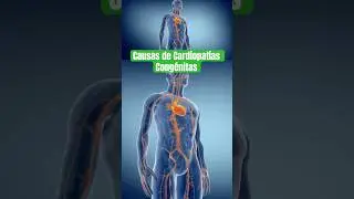 ✨Algunas Causas de Cardiopat&iacute;as Cong&eacute;nitas - Medicina en la Red