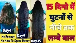 15 Days HAIR GROWTH CHALLENGE For LAZY & BUSY People | Best Hacks For Students & Working Person
