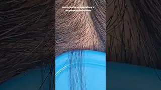 Sigues creyendo que el corte de cabello es la soluci&oacute;n a los piojos y liendres?